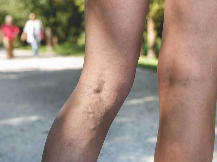 Detoximer - ¿Cómo funciona?